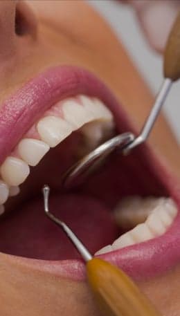 Especialidades Dentárias